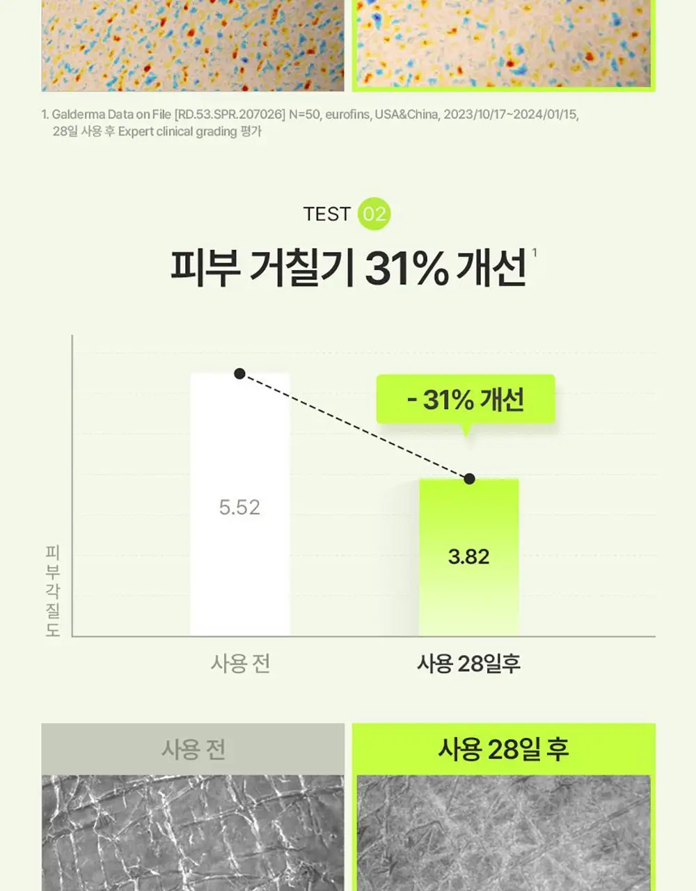 [29ml증정/닭살피부케어] 최립우 PICK 세타필 각질제거 SA 로션 473ml 상세페이지 10